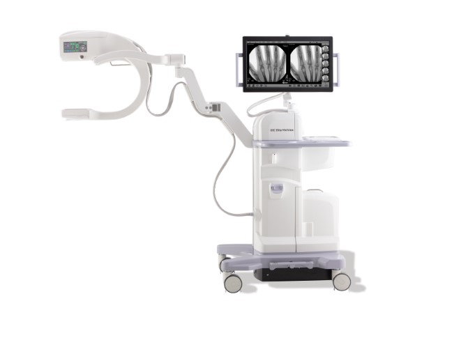 OEC MiniView（GEヘルスケア）：CMOSフラットディテクタを搭載した手術用のミニCアーム