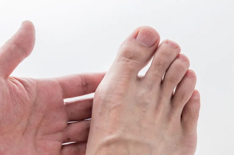 足指の痛み